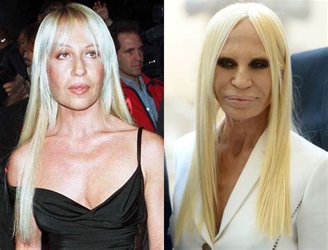 commento donatella versace|donatella versace before and after.